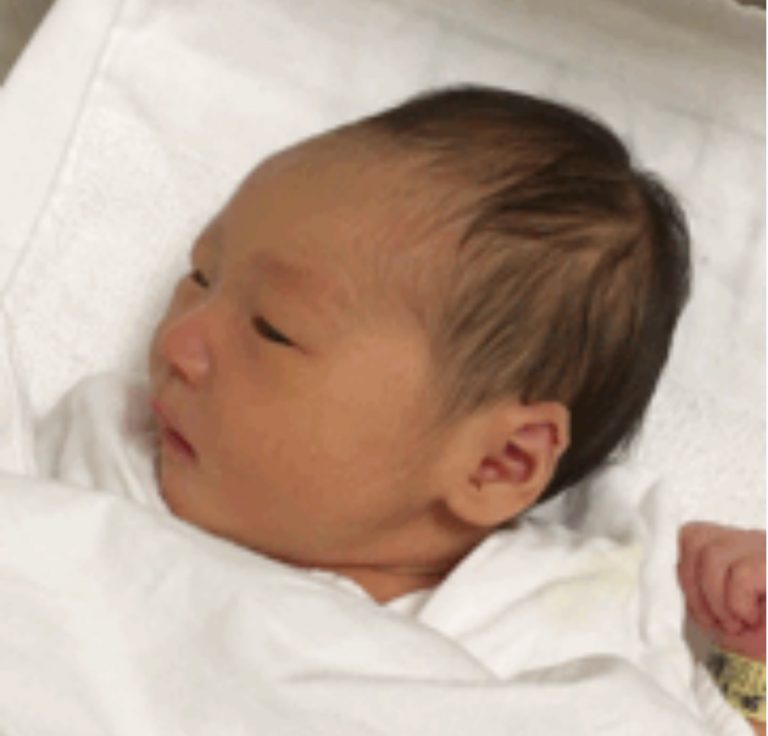 あかちゃんって、こんなにしゃっくりするの？