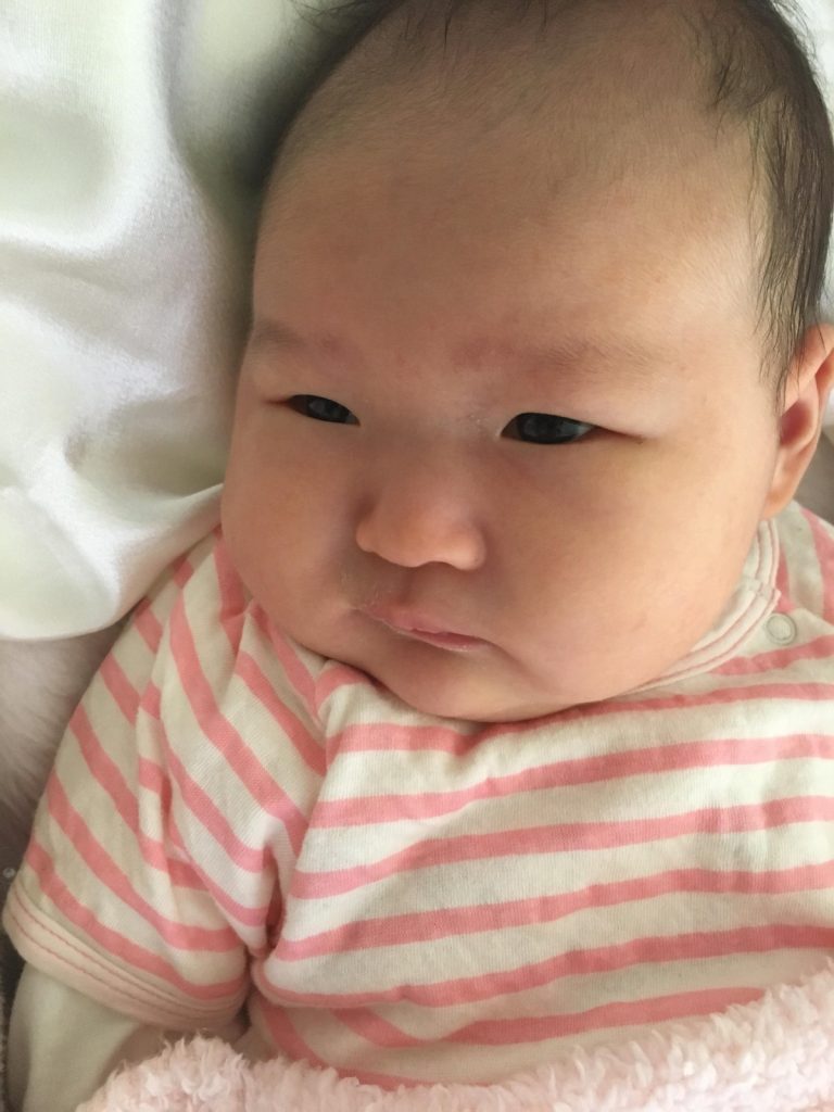 向こう傷のねね