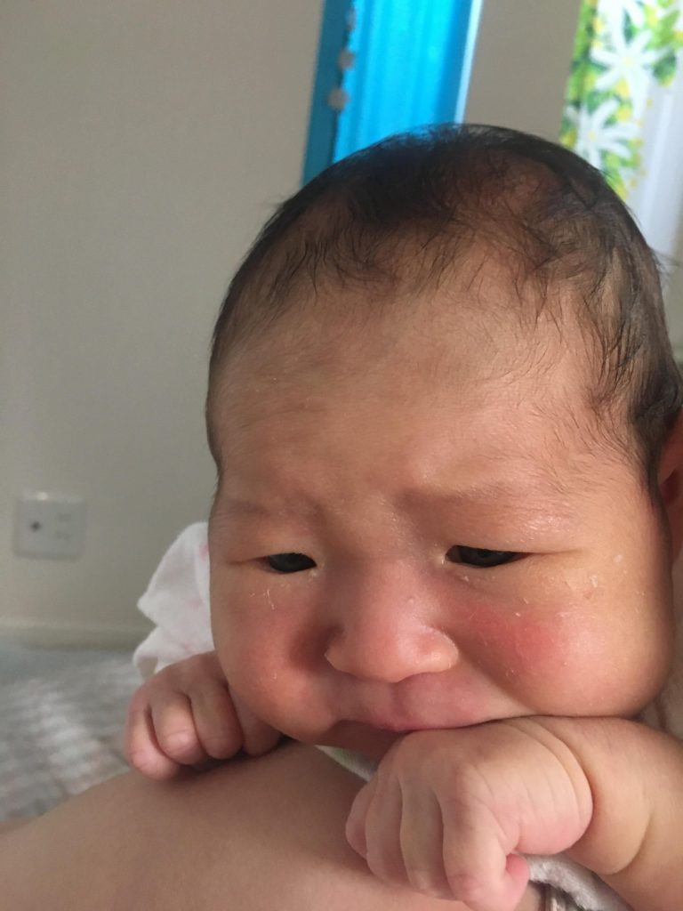 どうされました？　「げっぷが出ないんです」