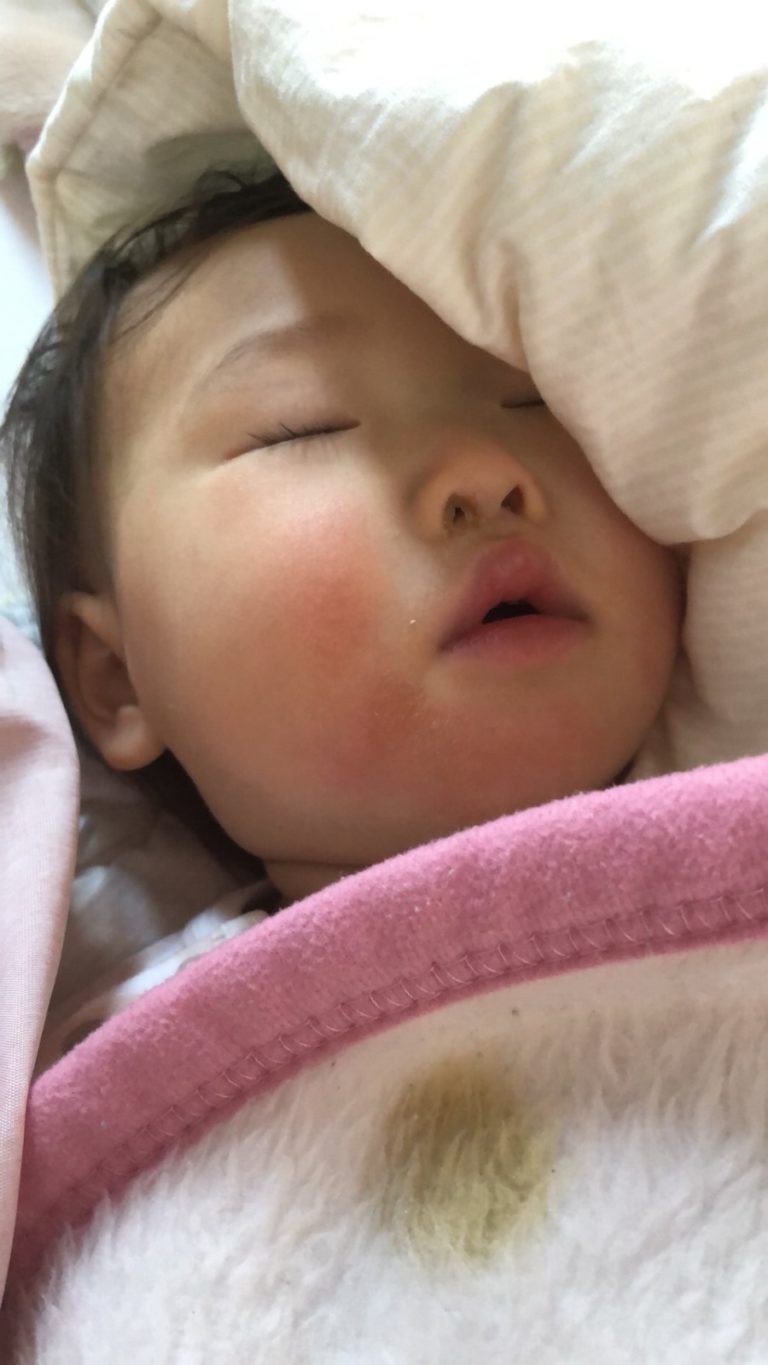 40度の熱が出た